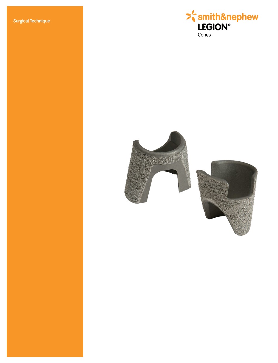 Smith Nephew Legion Cones Surgical Technique Pdf Download Manualslib