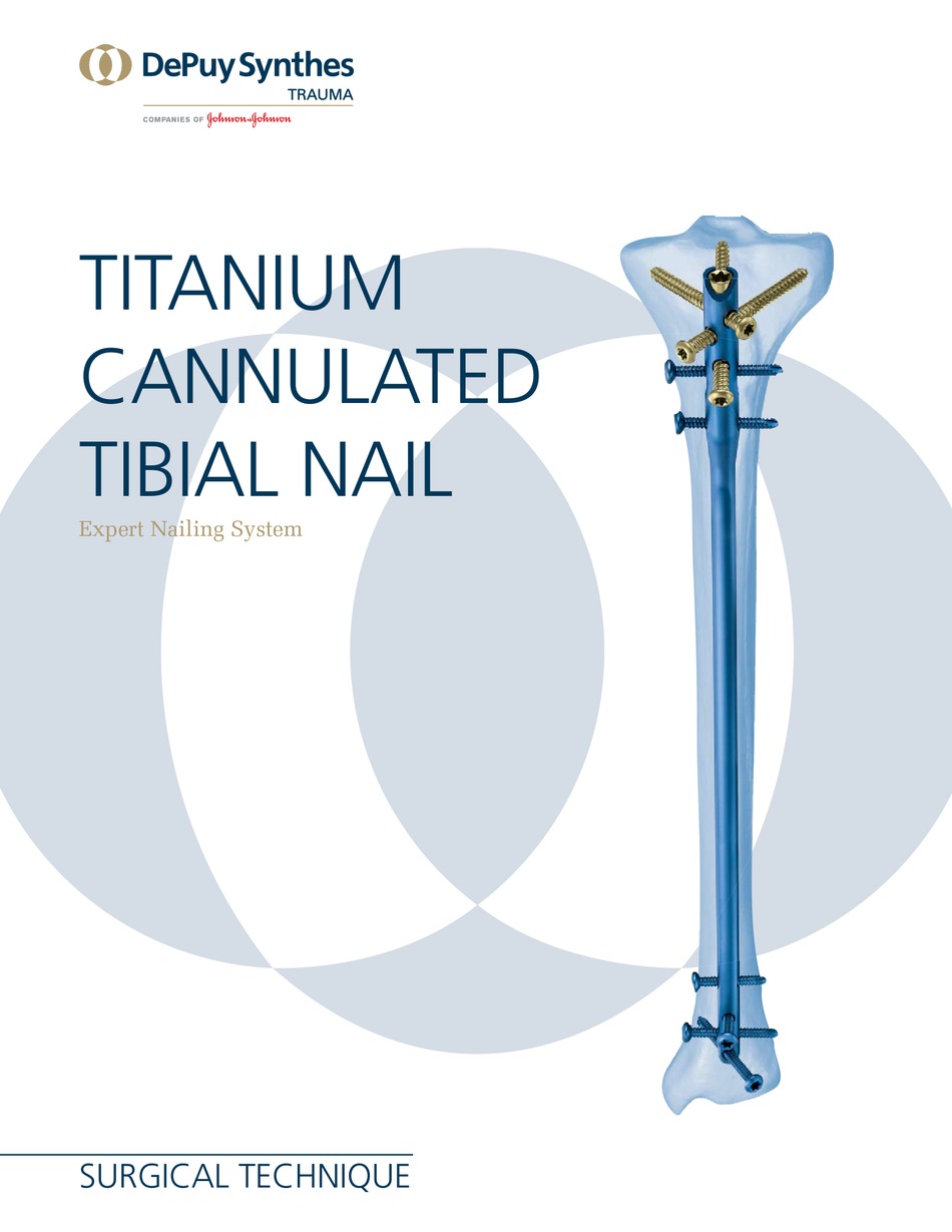 Expert-Tibial-Nail-Titanium-System-10-Unit-With-1-Unit-End-Cap-and-9-Unit-Screws  | eBay