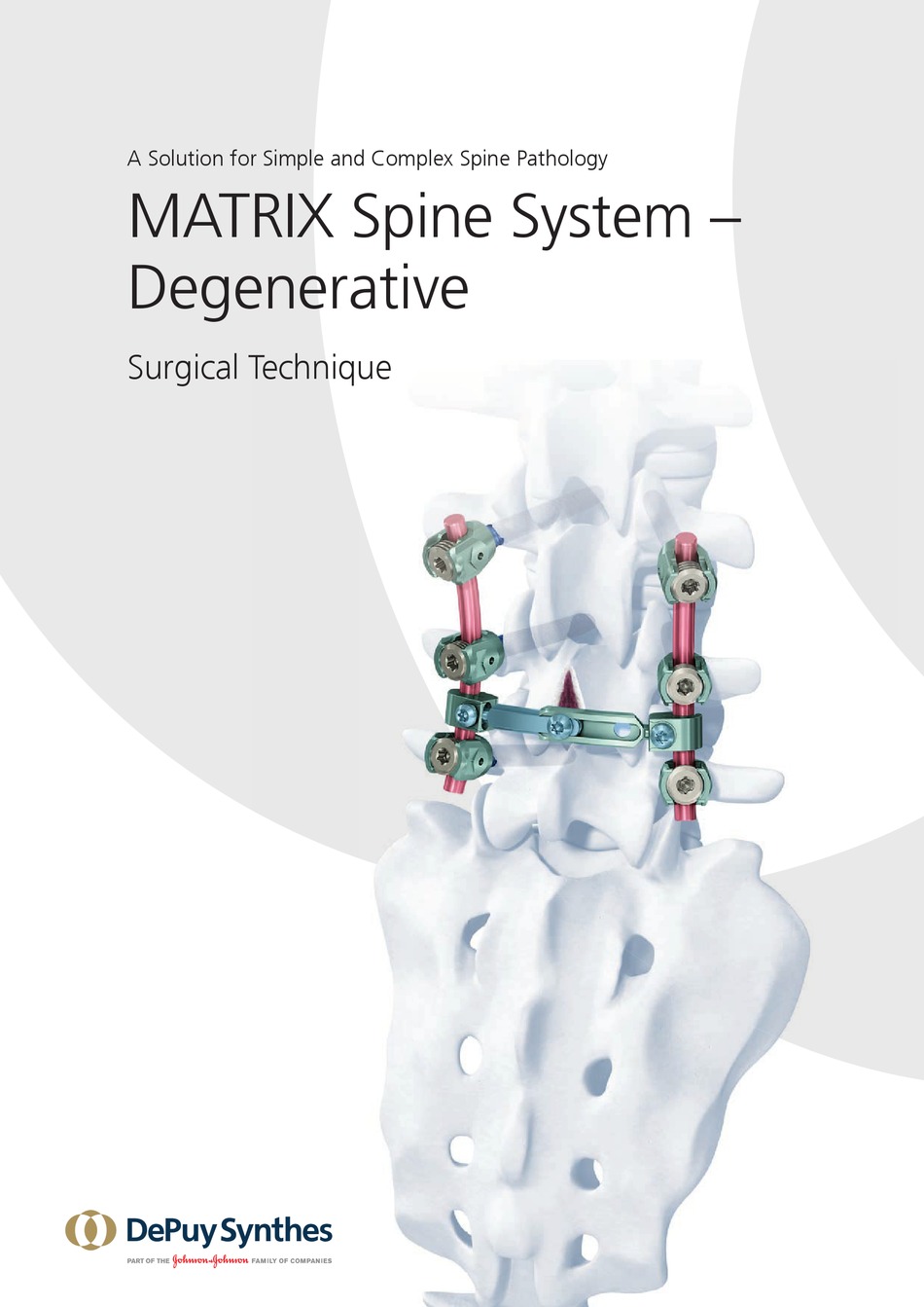 JOHNSON & JOHNSON DEPUY SYNTHES MATRIX SURGICAL TECHNIQUE Pdf Download