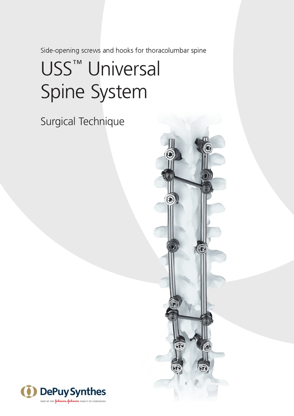SYNTHES USS UNIVERSAL SURGICAL TECHNIQUE Pdf Download | ManualsLib