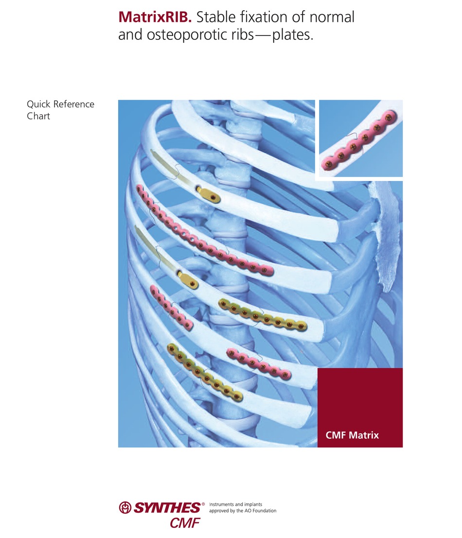 SYNTHES MATRIXRIB QUICK REFERENCE Pdf Download ManualsLib