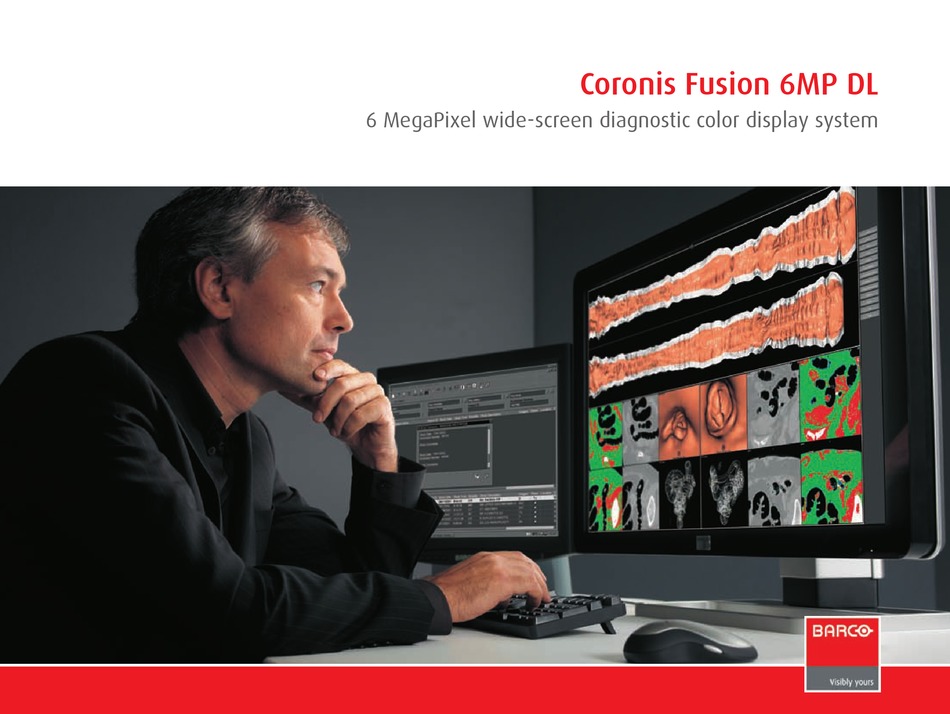 BARCO CORONIS FUSION 6MP MONITOR 