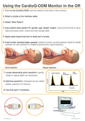 Deltex Medical CardioQ-ODM Manual