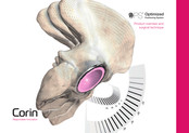 CORIN OPS Product Overview And Surgical Technique