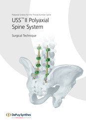 Synthes USS II Surgical Technique